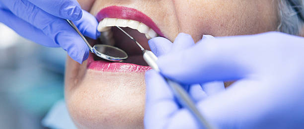 Best Broken or Chipped Tooth Repair in , CT